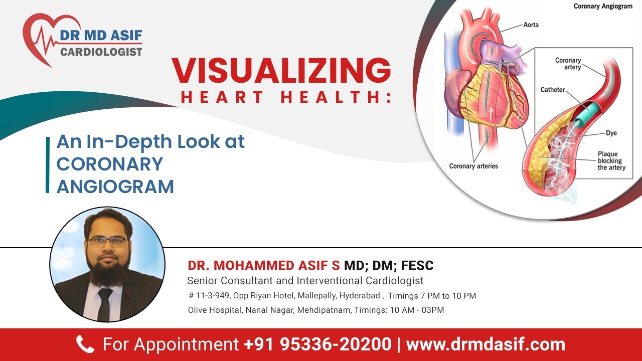 Visualizing Heart Health: An In-Depth Look at Coronary Angiogram